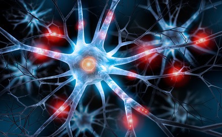 was ist alzheimer