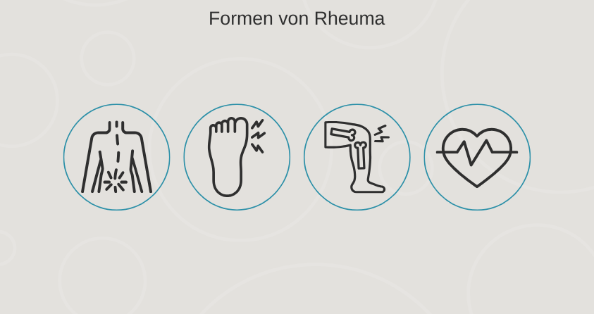 4&#x20;Hauptgruppen&#x20;von&#x20;Rheuma